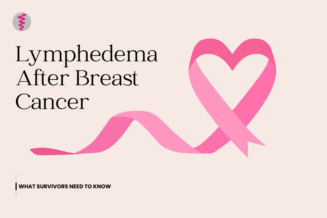 Lymphedema After Breast Cancer: What Survivors Need to Know